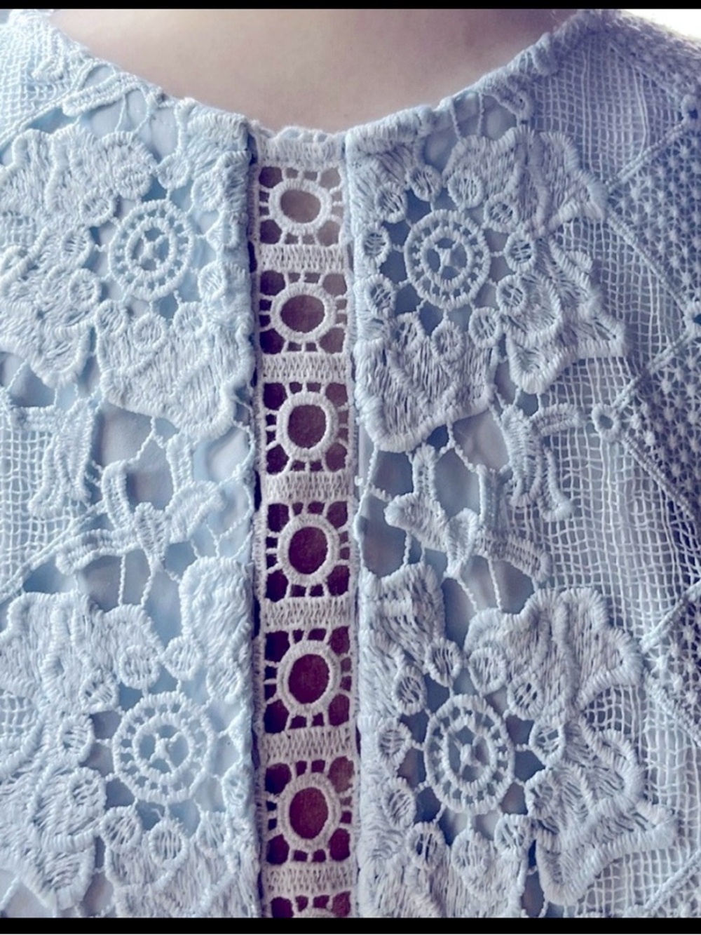 Ted Baker Light Blue Lace Dress